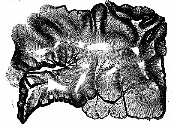 Изображение рельефа штрихами по шкале Лемана Изображение рельефа штрихами по шкале Лемана